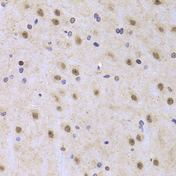 Anti-ILF2 Antibody (CAB5882)