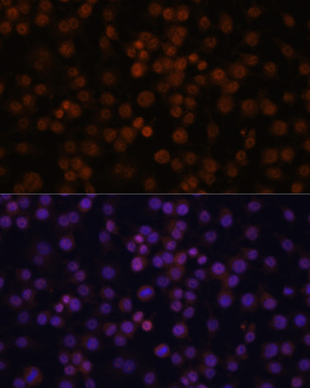 Anti-NFKBIZ Antibody (CAB10492)