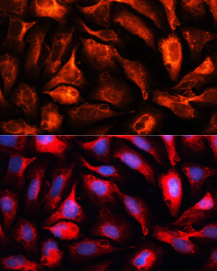 Anti-MAP1B Antibody (CAB3305)