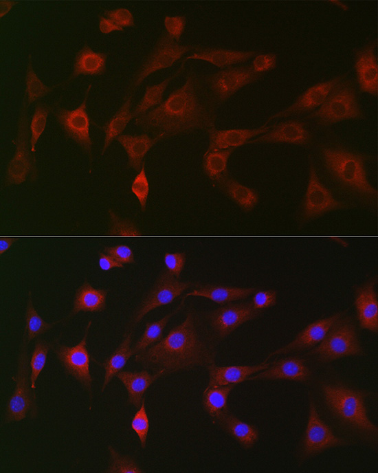 Anti-NLRC4 Antibody (CAB7382)