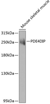 Anti-PDE4DIP Antibody (CAB7765)