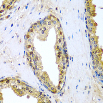 Anti-TNFSF10 Antibody (CAB2138)