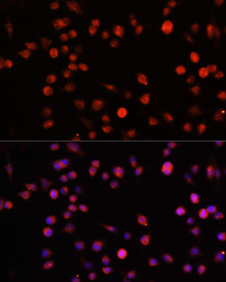 Anti-MUL1 Antibody (CAB13125)