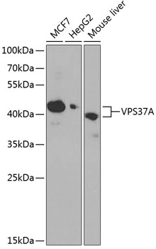 Anti-VPS37A Antibody (CAB14159)