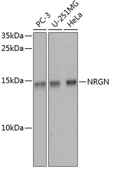 Anti-Neurogranin Polyclonal Antibody (CAB8444)