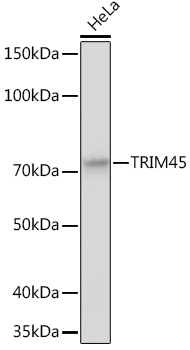 Anti-TRIM45 Antibody (CAB12739)