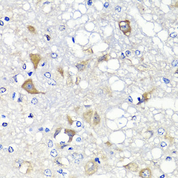 Anti-PSPH Antibody (CAB7924)