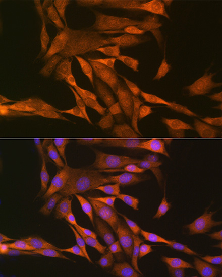 Anti-TXN Antibody (CAB7638)