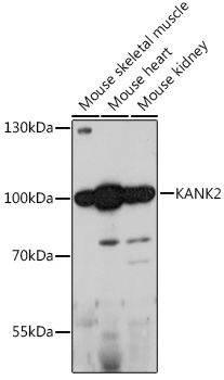 Anti-KANK2 Antibody (CAB15420)