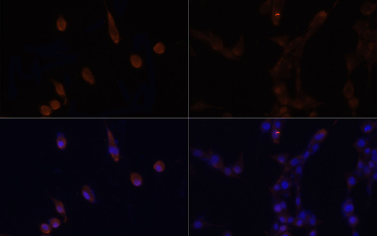 Anti-LC3B Antibody [KO Validated] (CAB11282)