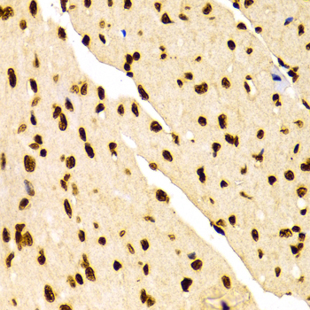 Anti-DiMethyl-Histone H3-K27 Antibody (CAB2362)