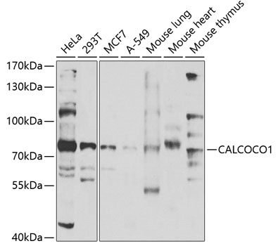 Anti-CALCOCO1 Polyclonal Antibody (CAB7987)