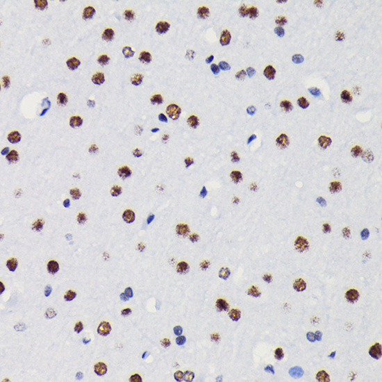 Anti-HDAC1 Antibody [KO Validated] (CAB19571)