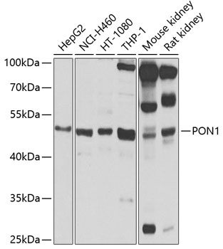 Anti-PON1 Antibody (CAB1321)