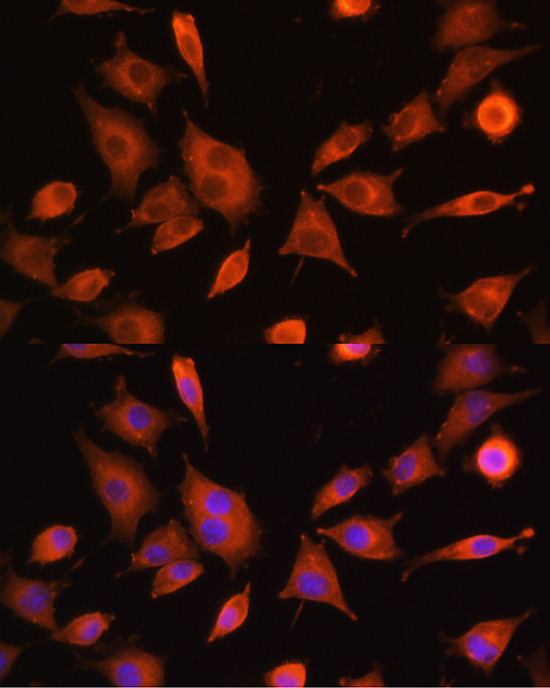 Anti-PFKM Antibody (CAB5477)