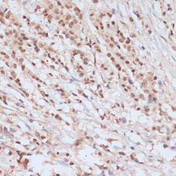 Anti-Phospho-BRCA1-S1423 Antibody (CABP0232)