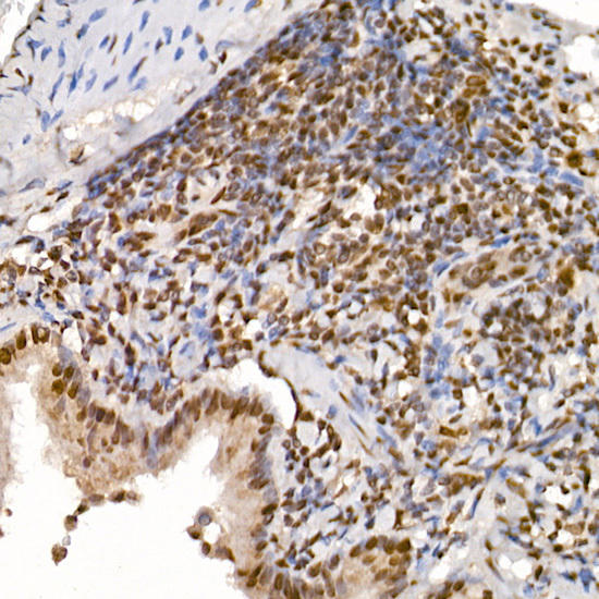 Immunohistochemistry of paraffin-embedded rat lung using TAF15 Rabbit mAb at dilution of 1:25 (40x lens). Perform high pressure antigen retrieval with 10 mM citrate buffer pH 6. 0 before commencing with IHC staining protocol.