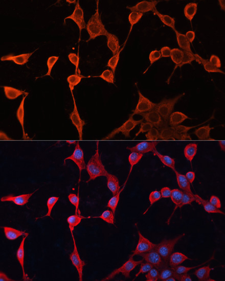 Anti-DNAJA2 Antibody (CAB7059)