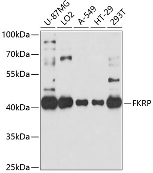 Anti-FKRP Antibody (CAB10194)