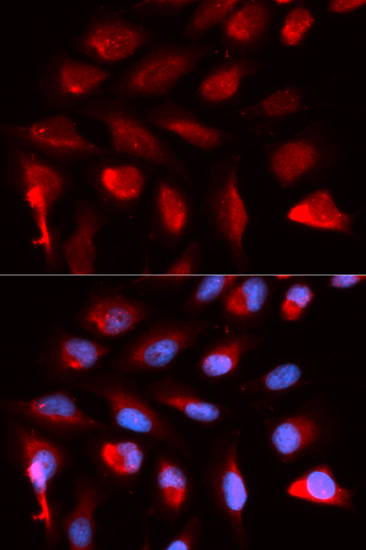 Anti-PPARD Antibody (CAB5656)