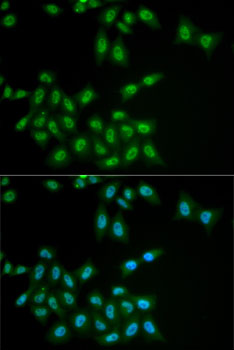 Anti-HPS1 Antibody (CAB6621)