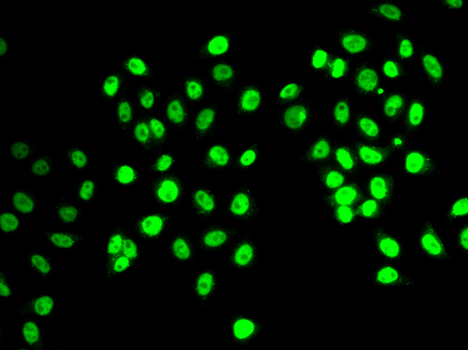 Anti-REST Antibody (CAB2230)