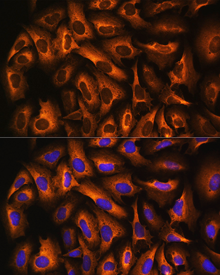 Anti-EEF1A1 Antibody (CAB0974)