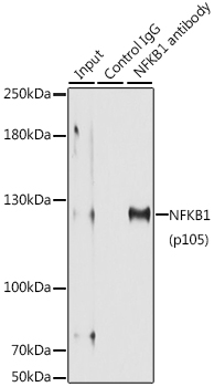 Anti-NFKB1 Antibody (CAB11160)