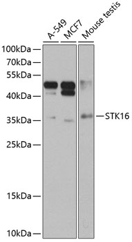 Anti-STK16 Polyclonal Antibody (CAB8166)