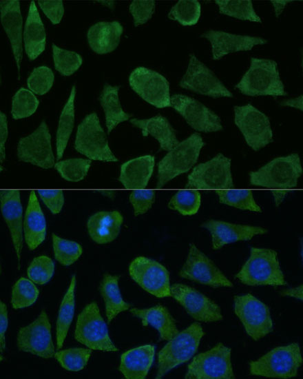 Anti-FKBP1B Antibody (CAB16375)