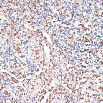 Anti-CTSG Antibody (CAB13172)