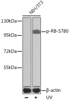 Anti-Phospho-RB1-S780 Antibody (CABP0444)