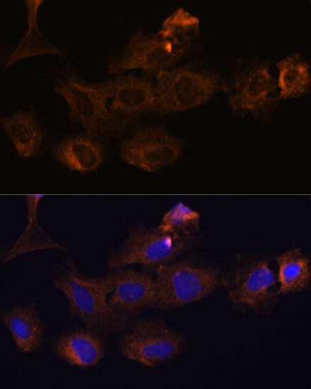 Anti-MMP25 Antibody (CAB3032)