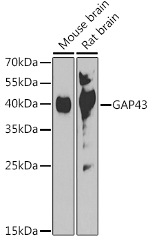 Anti-GAP43 Antibody (CAB16857)