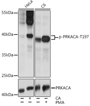 Anti-Phospho-PRKACA-T197 Antibody (CABP0557)