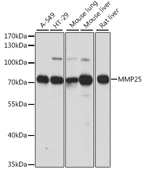 Anti-MMP25 Antibody (CAB15886)