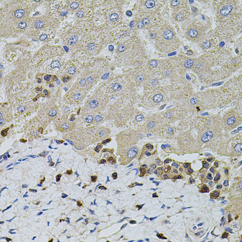 Anti-S100A12 Antibody (CAB5328)