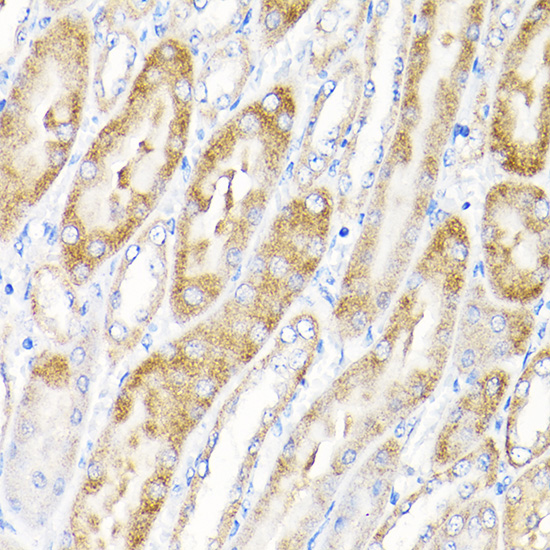 Anti-IKBKAP Antibody (CAB10127)