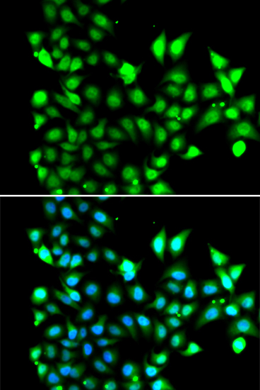 Anti-SNRPD2 Antibody (CAB13356)