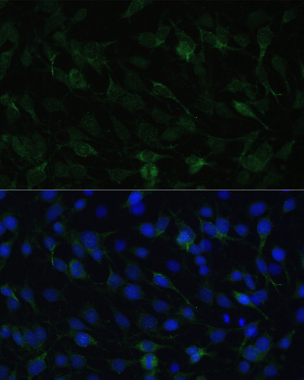 Anti-TAC1 Antibody (CAB13550)