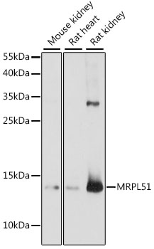 Anti-MRPL51 Antibody (CAB15838)