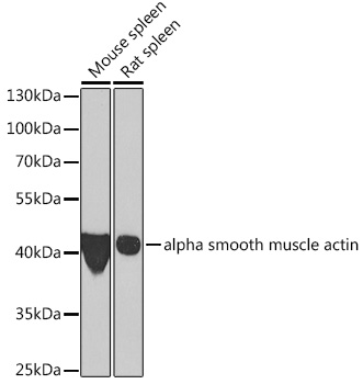 Anti-alpha smooth muscle actin Antibody (CAB7248)