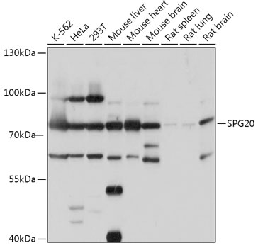 Anti-SPG20 Antibody (CAB17653)