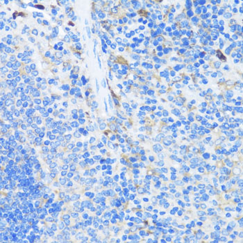 Anti-EIF3J Polyclonal Antibody (CAB8637)