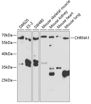 Anti-CHRNA1 Antibody (CAB5306)