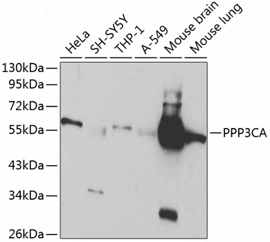 Anti-PPP3CA Antibody (CAB1063)