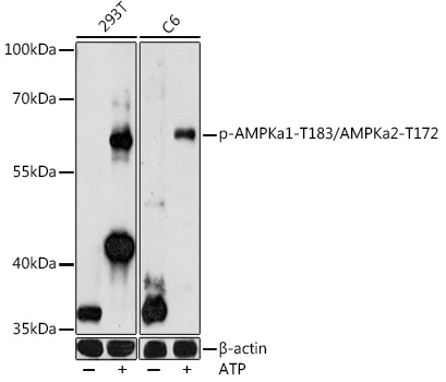 Anti-Phospho-PRKAA1-T183/PRKAA2-T172 pAb (CABP0883)