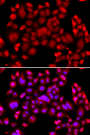 Anti-PIP4K2B Antibody (CAB12535)