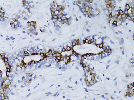 Anti-BRCA1 Antibody (CAB0212)