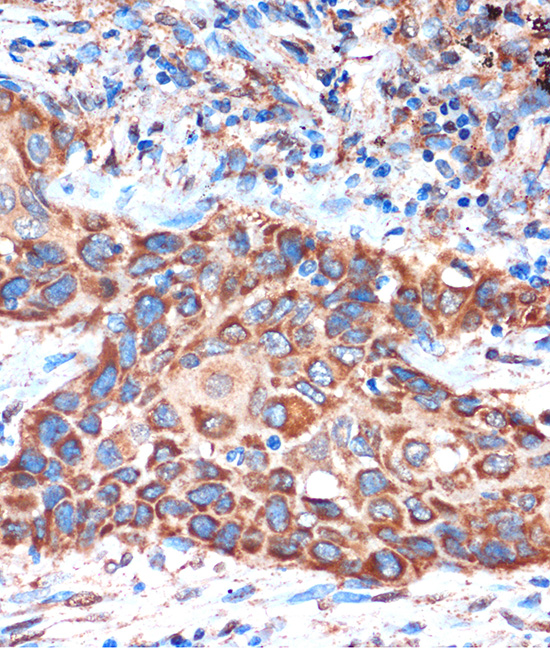 Anti-HIBADH Antibody (CAB1264)